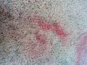 Stain Before